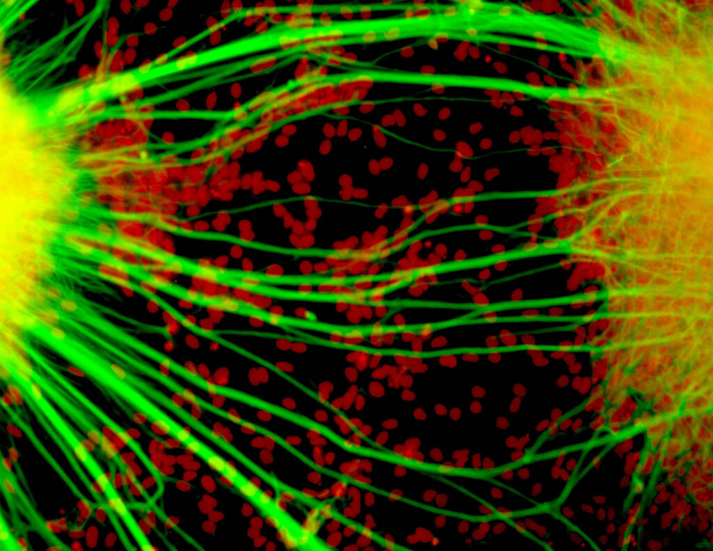 Human neurons viewed under a microscope at UCSD research labs 